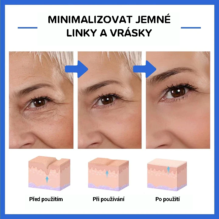 Botulinové sérum na obličej