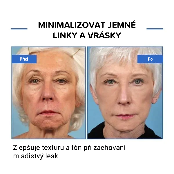Botulinové sérum na obličej