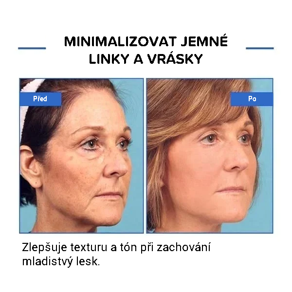 Botulinové sérum na obličej