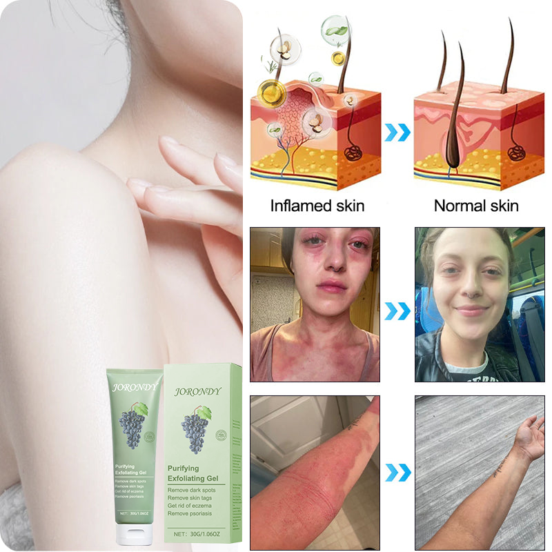 Čistící exfoliační gel