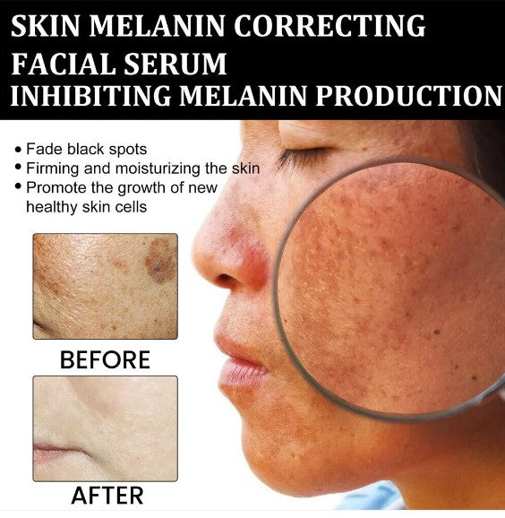 Obličejové sérum pro rychlé odstranění tmavých skvrn pro korekci melaninu
