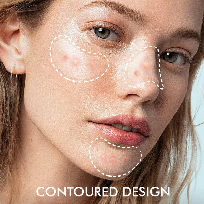 Hydrokoloidní náplasti na akné Clear Overnight Patches