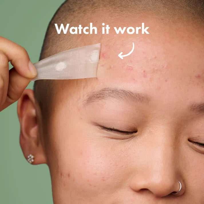Hydrokoloidní náplasti na akné Clear Overnight Patches