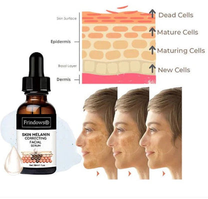 Obličejové sérum pro rychlé odstranění tmavých skvrn pro korekci melaninu
