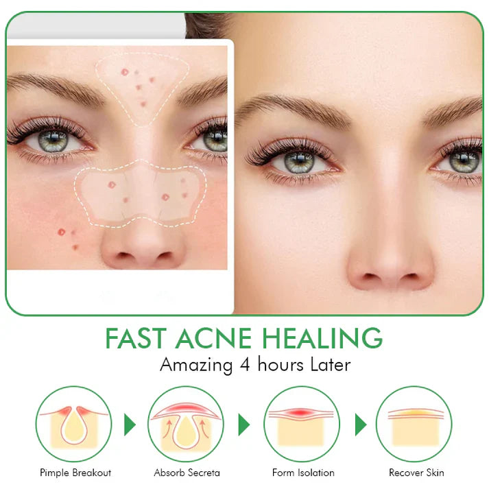 Hydrokoloidní náplasti na akné Clear Overnight Patches