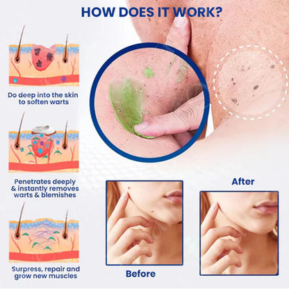 Gel na okamžité odstranění znamének a skvrn NatureErase