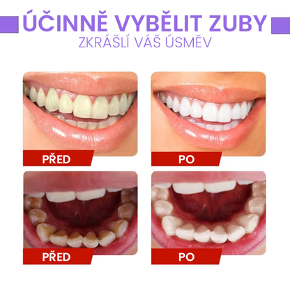 Korektor barvy zubů a sérum pro péči o sklovinu🔮🔮🔮