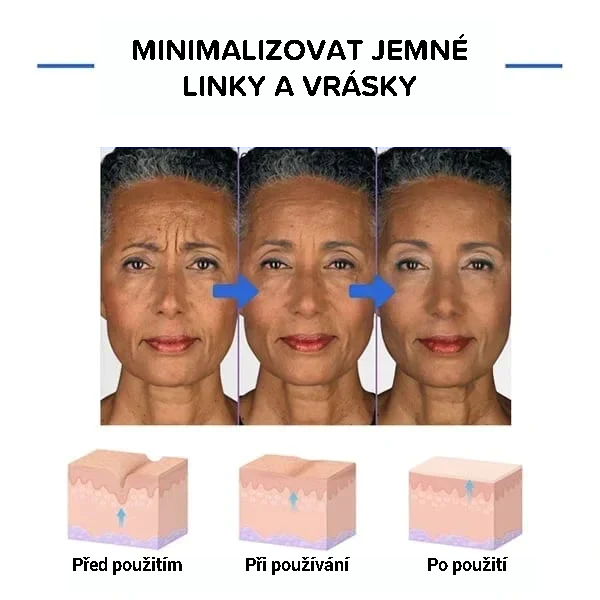 Botulinové sérum na obličej