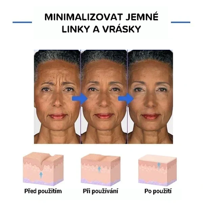 Botulinové sérum na obličej