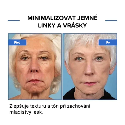Botulinové sérum na obličej